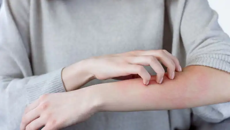 Gözden Kaçan Cilt Kanseri Belirtileri: Dermatologların Açıklamalarıyla Bilinçlenin