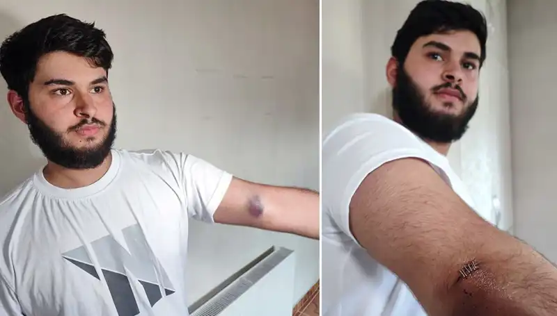 Bahçeye Kaçan Top, Mahallede Eğlenceli Kaosa Neden Oldu!